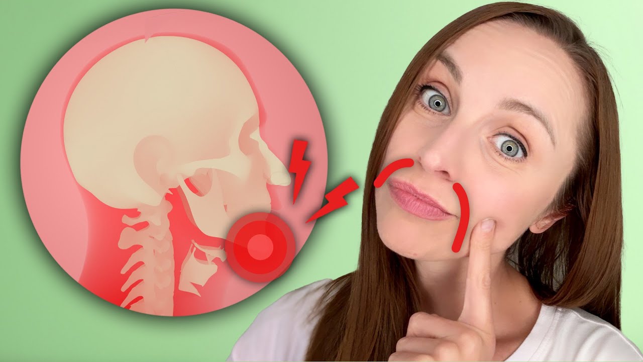 Marionettenfalten loswerden - Diese Übung ist natürliches Lifting!