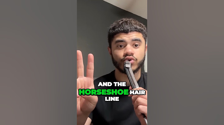 The 3 Types of Hairlines