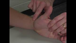 MMT Individual Muscle Extensor Pollicis Brevis (EPB)