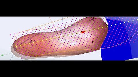 Lasercam Orthotics Tutorial - Using Adjust in the Editor
