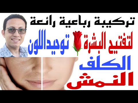 تفتيح البشرة وعلاج النمش والكلف والتصبغات بتركيبة رائعة