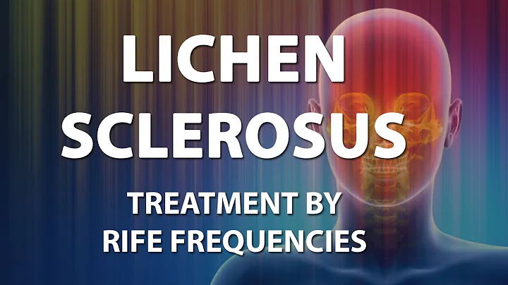 Lichen Sclerosus - RIFE Frequencies Treatment - Energy & Quantum Medicine with Bioresonance