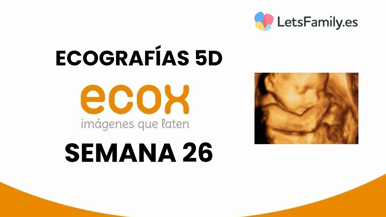 Ecografía 5D: semana 26 de embarazo
