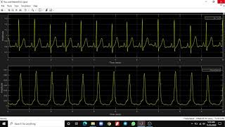Implementation of Real-Time ECG QRS Detection | Using DSP System Toolbox screenshot 1