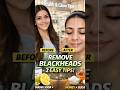 Blackheads Remove Karne Ke 2 Powerful Gharelu Totkay | #skincare #brightskin #cleanskin #deepcleanse