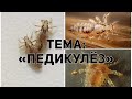 Педикулёз