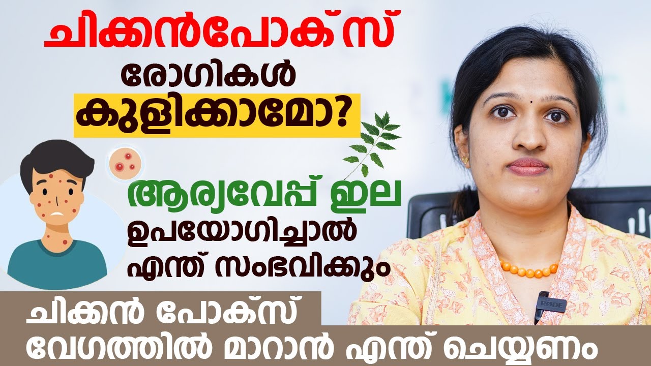 ചിക്കൻപോക്‌സ് രോഗികൾ കുളിക്കാമോ? ആര്യവേപ്പ് ഇല ഉപയോഗിച്ചാൽ എന്ത് സംഭവിക്കും | About Chickenpox