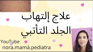 إلتهاب الجلد التأتبي Dermatitis atópica (árabe)