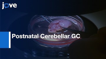 Postnatal Cerebellar GC Migration Imaging by Confocal Macroscopy | Protocol Preview