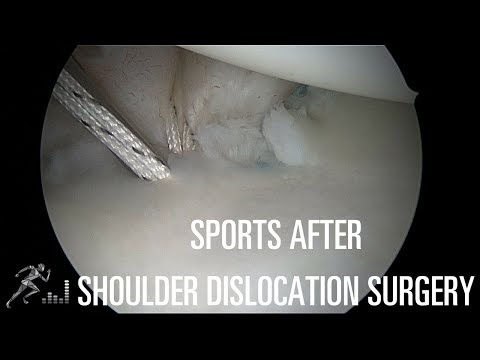 Return to play after shoulder dislocation surgery