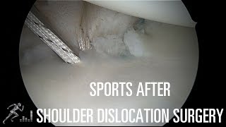 Return to play after shoulder dislocation surgery