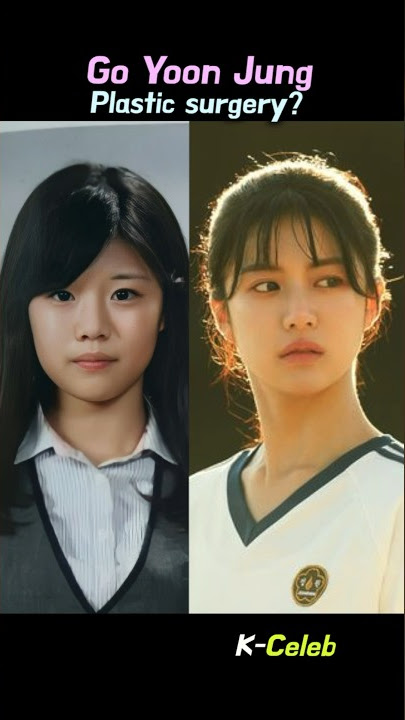 plastic surgery controversy? #disney #movingkdrama #goyoonjung