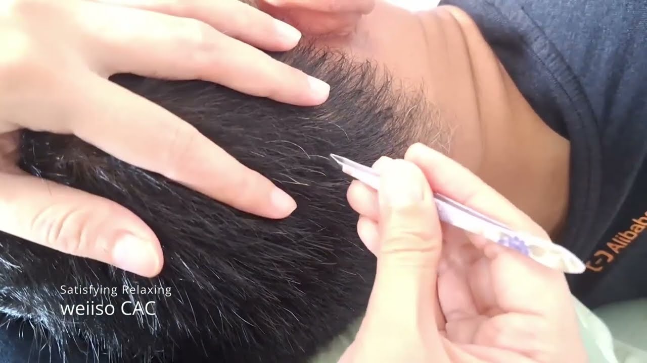 Satisfying Relaxing Cabut Uban #20