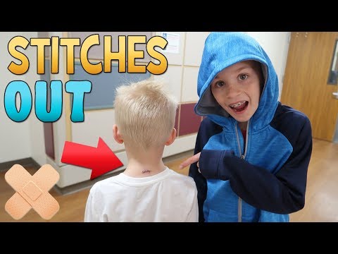 Stitches Out Party & HUGE Storm! || Mommy Monday
