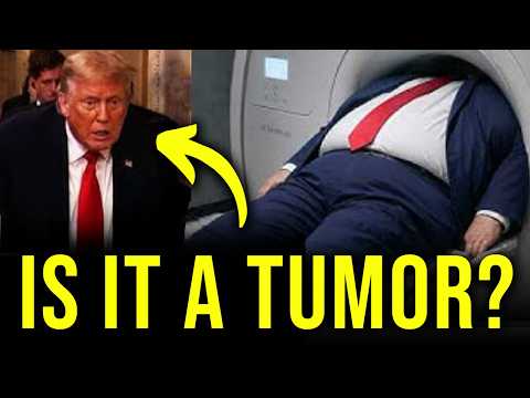 REAL DOCTOR: Trump went back to the hospital today (clues they are monitoring a tumor?)