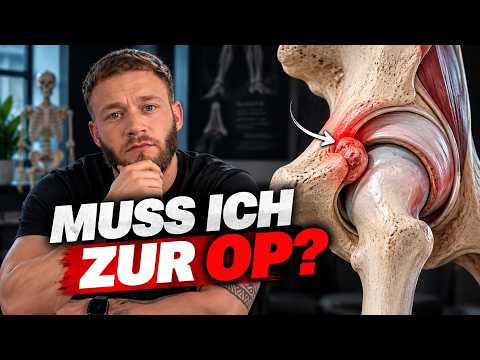 Hüftimpingement und Labrumriss: Ist eine OP wirklich notwendig?