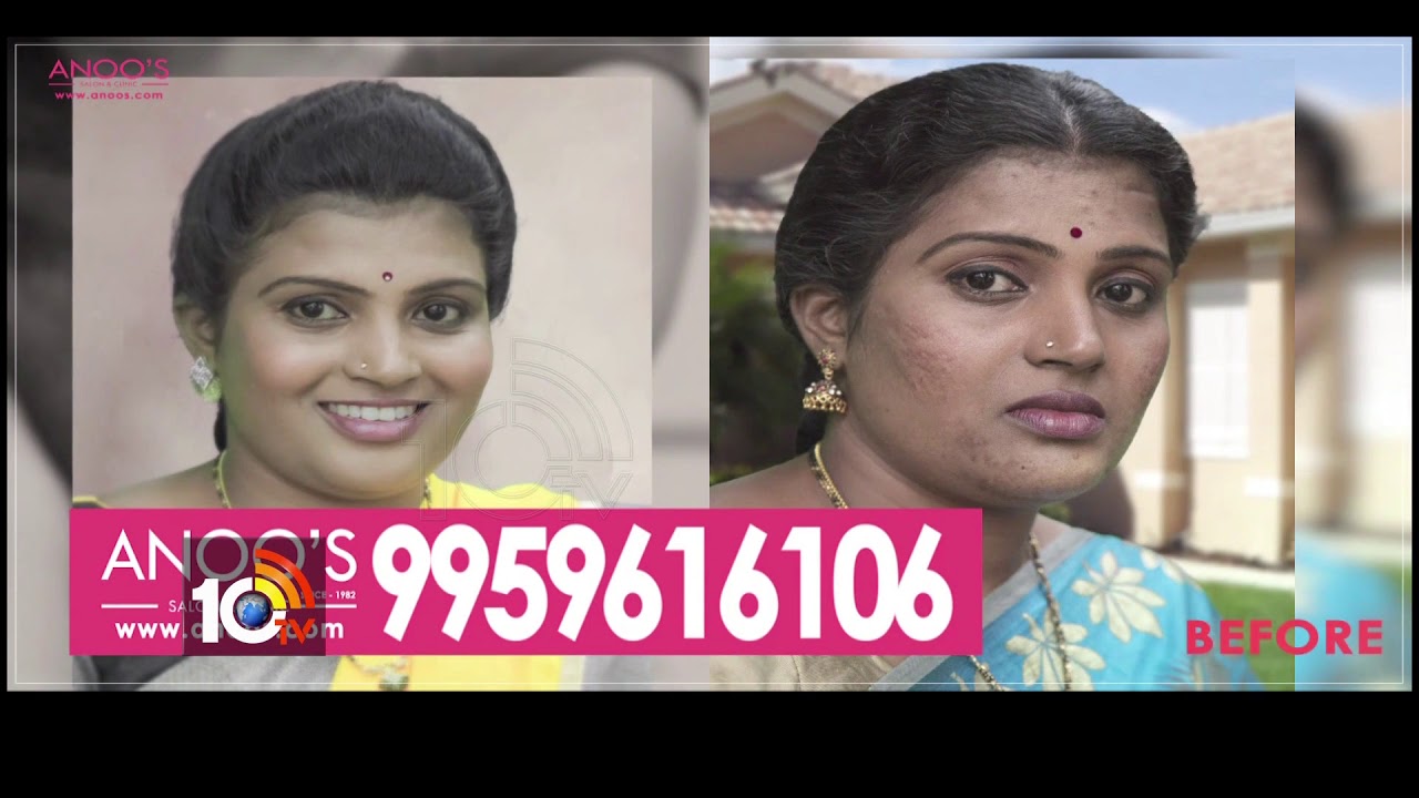 హెయిర్ సమస్యతో బాధపడుతున్నారా..? | Hair Loss & Beauty Tips | Anoo’s Salon & Clinic | 10TV