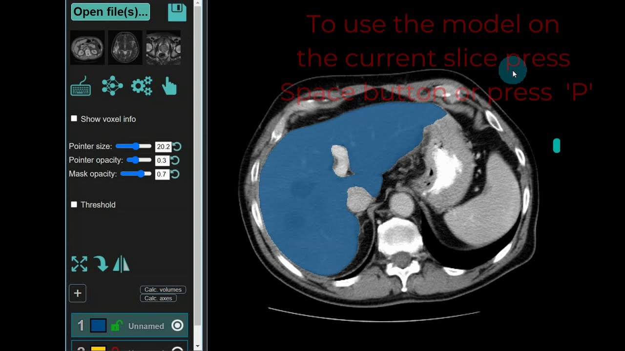How to activate models in MedSeg