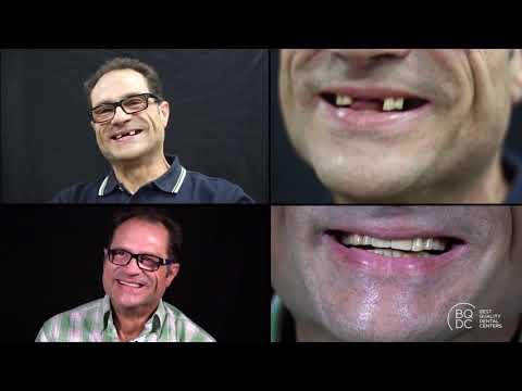 Testimonio Implantes Dentales