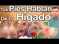 ALERTA! 8 Cosas Que Tus Pies Revelan Sobre Tu Hígado - Signos Que Revelan Sobre El Daño Hepático