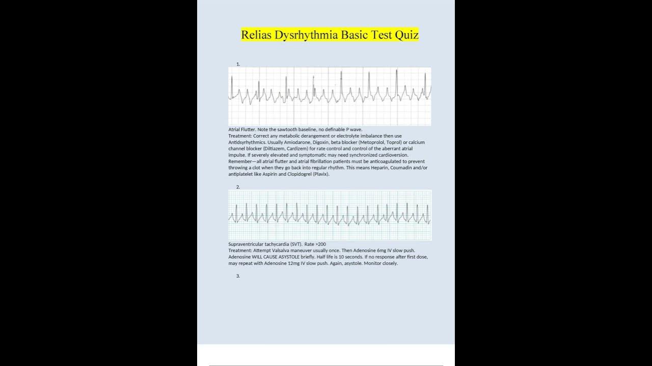 RELIAS DYSRHYTHMIA BASIC TEST QUIZ QUESTIONS AND ANSWERS 2022/2023