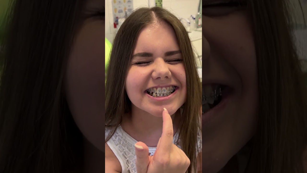 MENJAM GUMICE NA PROTEZI