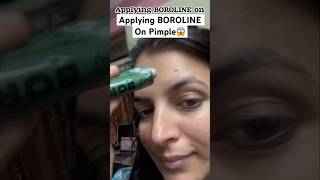 Live Resultsboroline For Acne