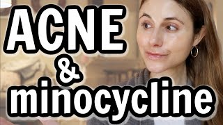 Minocycline Versus Doxycycline For Acne Dr Dray