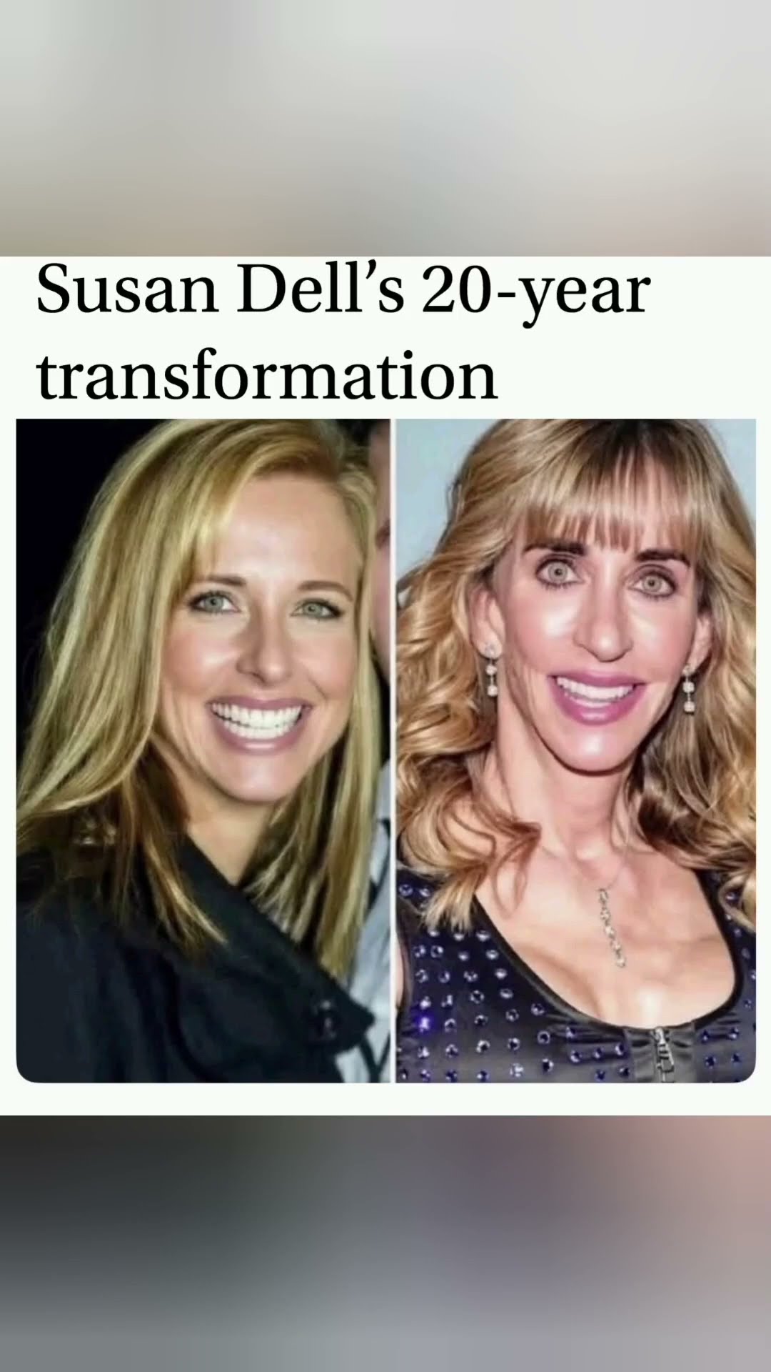 Susan Dell’s Incredible 20-Year Transformation#viral#usa#funnyshorts#trendingshorts #transformation