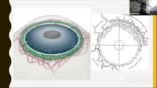 Glaucoma Support Group: Glaucoma Surgery