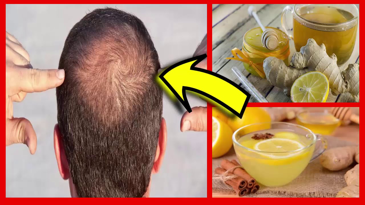 ESTAS 3 RECEITAS VAO FAZER DIMINUIR A QUEDA DE CABELO - YouTube