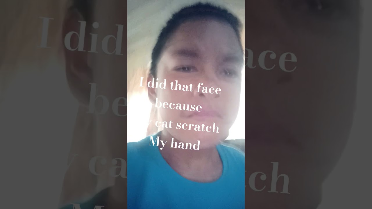 cat scratch there owner