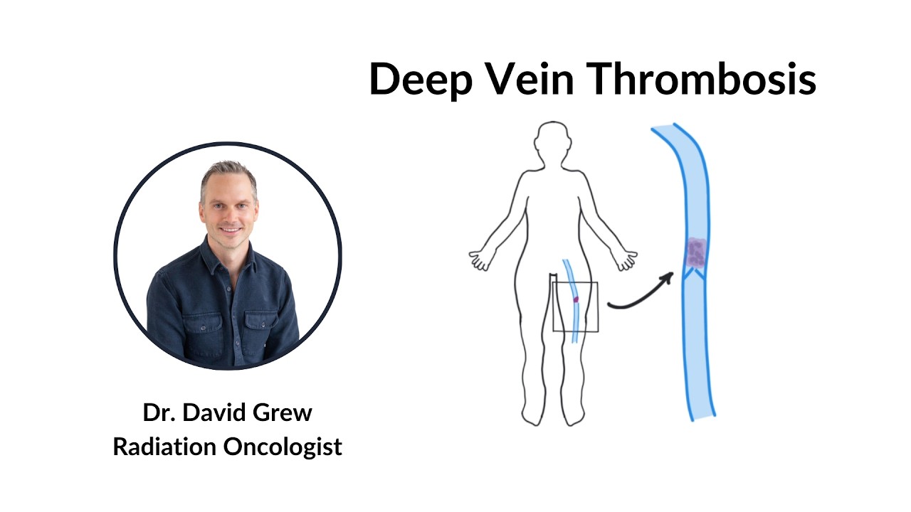 Что такое тромбоз глубоких вен?