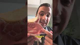 Technique to control nosebleeds! #shorts Technique to control nosebleeds! #shorts