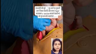 c- section वाली मां को तुम कमजोर बताते हो..  #shorts #ytshorts