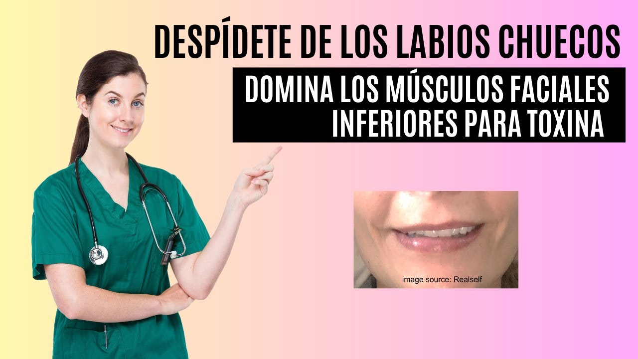 APRENDA LOS MÚSCULOS DE LOS LABIOS Y EVITE LAS ASIMETRÍAS INDUCIDAS POR EL BOTOX