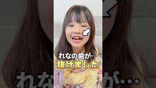 姉の歯が抜けたときの妹の反応w #shorts