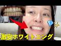【家で20分】ケチ女は月100円で歯白くしてます🦷