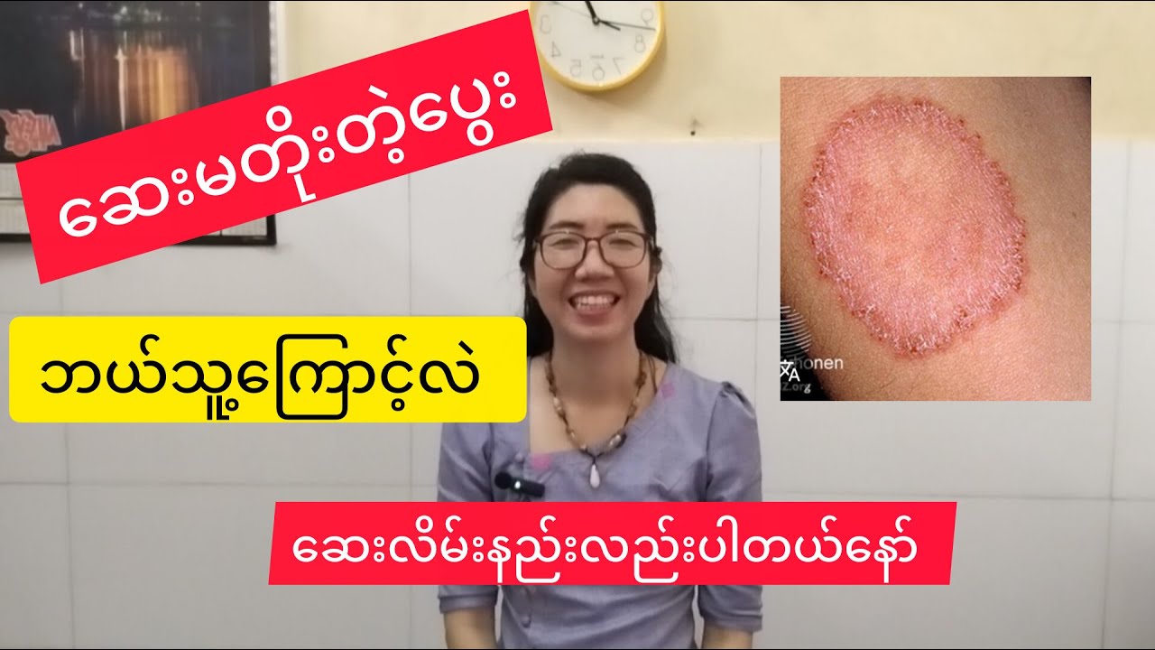 ပွေးတွေမပျောက်ဘူးဆိုတဲ့ထဲကတချက်ဖြစ်တဲ့ဆေးယဉ်ပါးနေတဲ့အကြောင်း