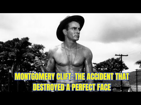 Unique Montgomery Clift Before And After Accident Manual - si6vbjh