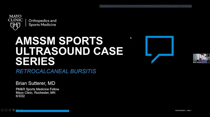 Retrocalcaneal Bursitis with Dr. Brian Sutterer | ...