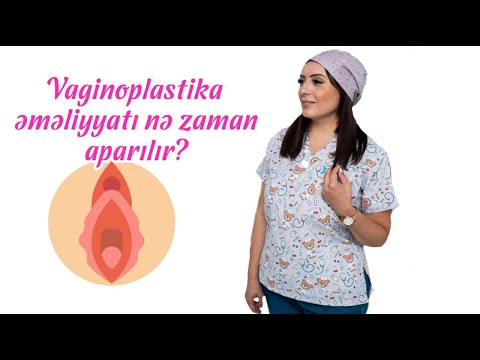 Vaginoplastika əməliyyatı nə zaman aparılır?