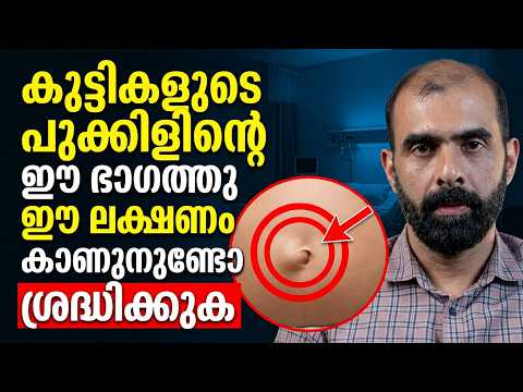 Do you see this symptom near your child's belly button? Pay attention / Dr. Murli Krishnan / Hernia