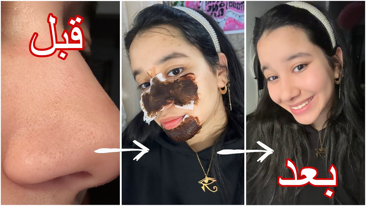 التخلص من الرؤوس السوداء بمكونين فقط في كل بيت🤩🎀من اول مره هتتخلصي من كل الرؤوس🤩 |تجهيزات العيد🎀