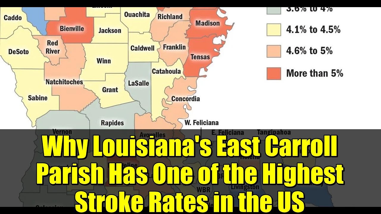 Почему в округе Ист-Кэрролл штата Луизиана один из самых высоких показателей инсультов в США?