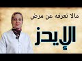 الإيدز 