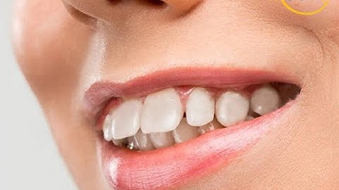 [trực tiếp] CÙNG BẠN SỐNG KHỎE (21/9): CÁC PHƯƠNG PHÁP ĐIỀU TRỊ RĂNG HÔ