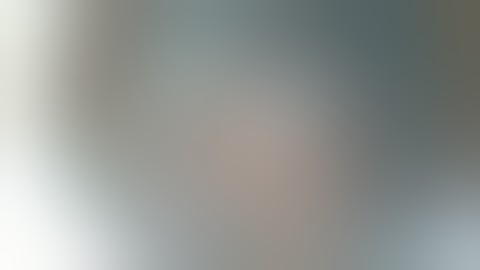Phacoemulsification of soft cataract