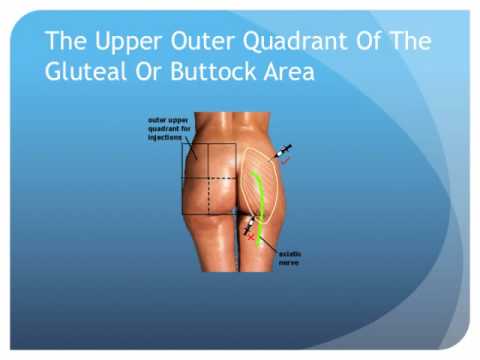 Inject steroids in glute