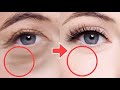 Eye Lifting Massage For Eye Bags, Eye Wrinkles, Dark Circles Under Eyes, Droopy Eyelids, Bigger Eye